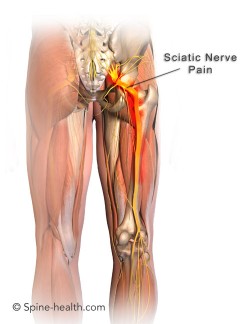 Pad placement pain relief