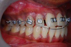 Orthodontist Las Vegas