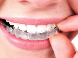 Las Vegas Orthodontics