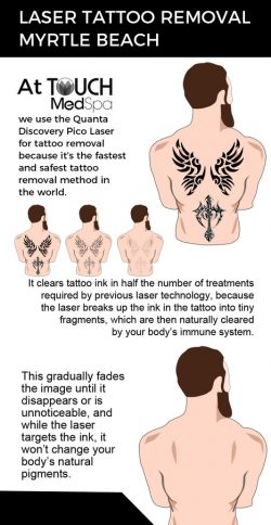 Visit Touch MedSpa for Fast and Safe Laser Tattoo Removal Services