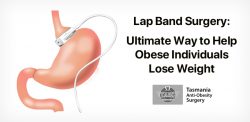 Lap Band Surgery: An Ultimate Way to Help Obese Individuals Lose Weight