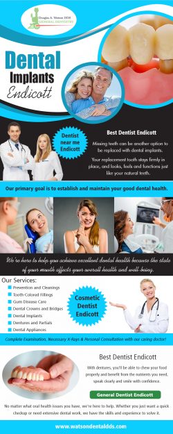 Dental Implants Endicott