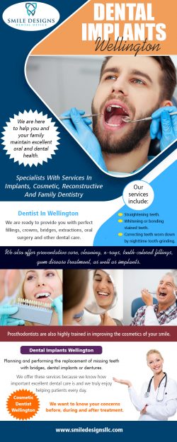 Dental Implants Wellington