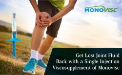 Get Lost Joint Fluid Back with a Single Injection Viscosupplement of Monovisc