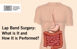 Lap Band Surgery: What is It and How It is Performed?