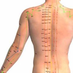 acupuncture treatment in derby