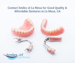 Contact Smiles of La Mesa for Good Quality & Affordable Dentures in La Mesa, CA