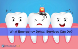 What Emergency Dental Services Can Do? Smile Select Dental