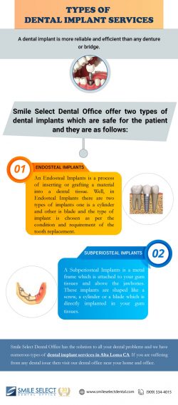 Types of Dental Implant Services