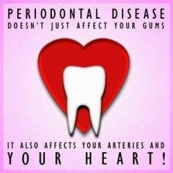 Periodontal Care in California | Smile Select Dental