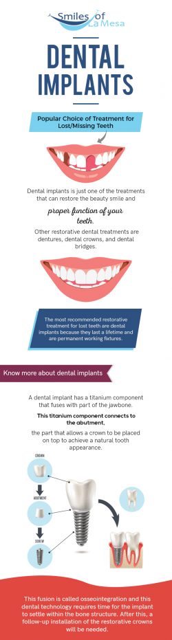 Replace your Missing Teeth with Quality Dental Implants in La Mesa, CA from Smiles of LA Mesa