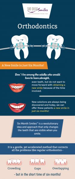 San Diego Smile – Top-rated Dental Clinic for Orthodontic Treatment in El Cajon, CA