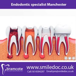 Endodontic specialist Manchester