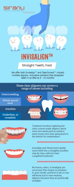 Get Straight Teeth Faster with Invisalign from Siranli Implants & Facial Aesthetics & Pr ...