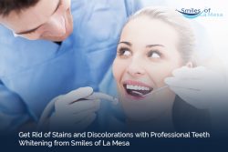 Get Rid of Stains and Discolorations with Professional Teeth Whitening from Smiles of La Mesa