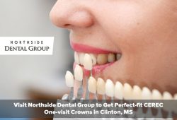 Visit Northside Dental Group to Get Perfect-fit CEREC One-visit Crowns in Clinton, MS