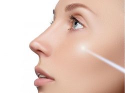 Acne Scar Laser treatment in Chandigarh