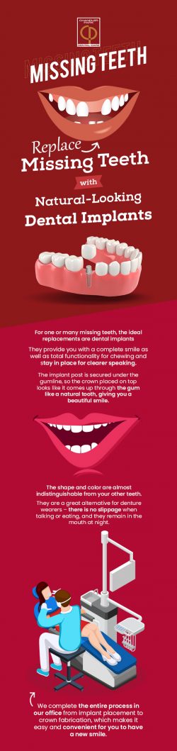 Replace Missing Teeth with Natural-looking Dental Implants from Chandler Park Dental Care