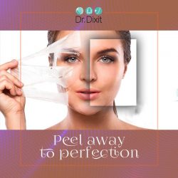 Chemical Peels Cost in Bangalore