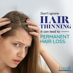 Hair loss Doctor in Chandigarh