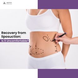 Best liposuction surgeon in Delhi