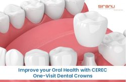 Improve your Oral Health with CEREC One-Visit Dental Crowns