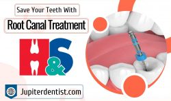 Painless Endodontic Treatment