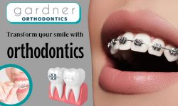 Leading Dental Clinic for Orthodontic Treatment