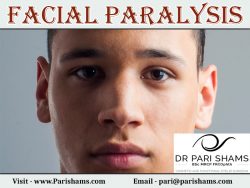 Facial Paralysis At Pari Shams