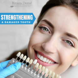 Restore the Natural Strength to your Teeth