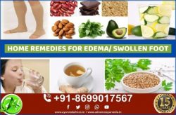 Ayurvedic Treatment for Swelling