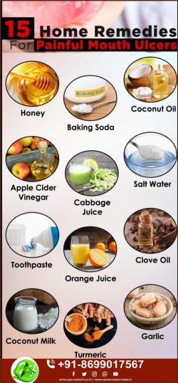 Herbal Remedy for Mouth Ulcers