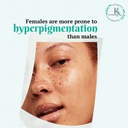 Pigmentation Laser Treatment in Hyderabad