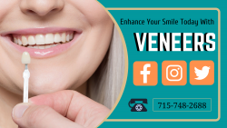 Veneers Dental Treatment Services