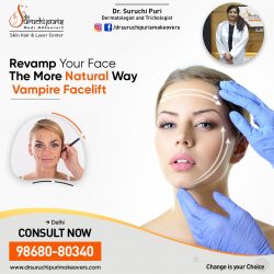 Vampire Facelift Treatment in Delhi