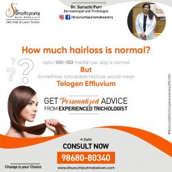 Best Hair Clinic in Delhi