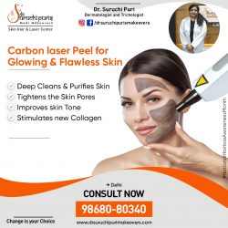 Carbon Laser Peel Treatment in Delhi