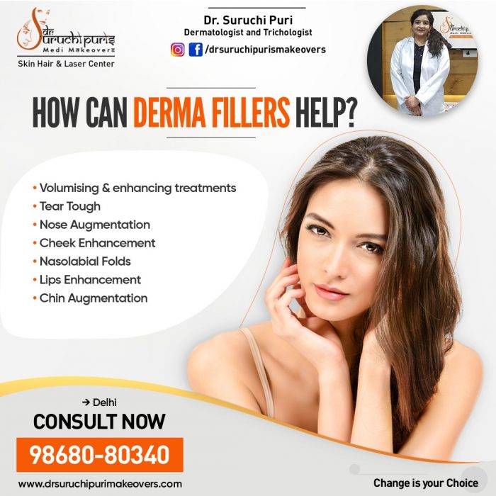 Dermal Fillers Treatment in Delhi