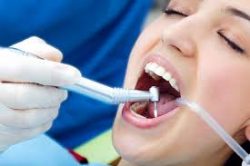 Cosmetic Dental Services in Houston Tx