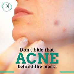 Acne Treatment in Hyderabad