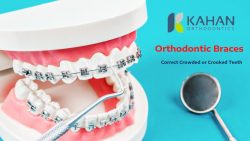 Advanced Orthodontics to Straighten Your Teeth