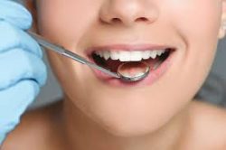 Disadvantages of deep cleaning teeth compared to periodontitis