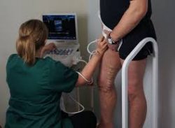 Spider Vein Treatment Center Clifton