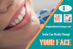 Bringing Life to Your Smile