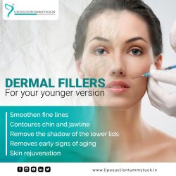 Dermal Fillers in Cardiff