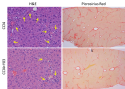 A Mitochondrial Uncoupler for NASH Treatment – Protheragen