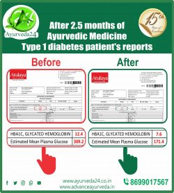 Ayurveda Treatment for Type 1 Diabetes