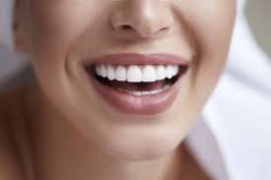 Best Teeth Whitening Dentist in Manhattan