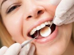 Same Day Dental Teeth Cleaning Near Me