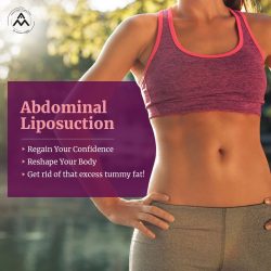 Tummy Tuck Surgery In Delhi